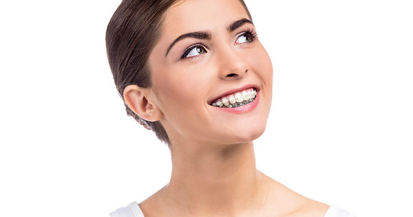 Orthodontie invisible: les adultes ne veulent plus de appareils orthodontiques visibles.